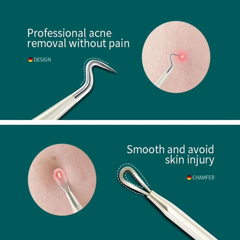 MR.GREEN Acne Remover Needles Blackhead Removal Pimple Comedone Extractor Set B